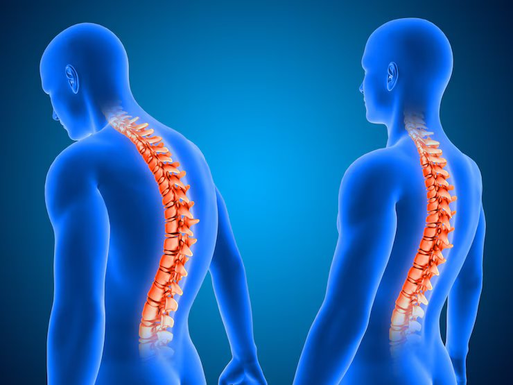Spinal Care